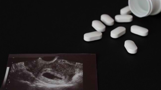Thumbnail Artikel Longgar Pengawasan Penjualan Obat Aborsi di Internet